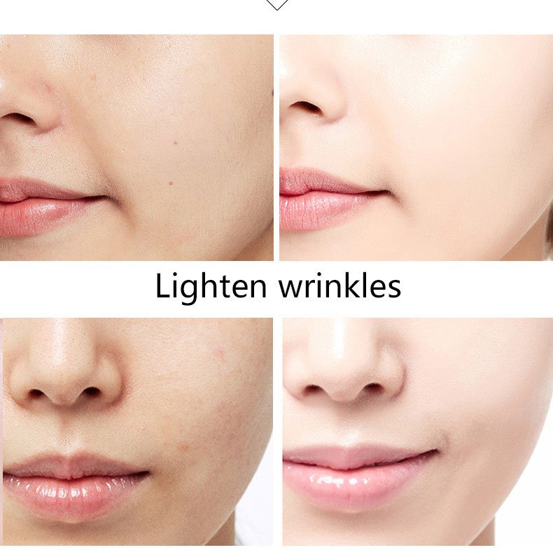 سيروم بخلاصة الذهب عيار 24 و كولاجين مقاوم للتجاعيد ومبيض ومرطب - الصورة 9